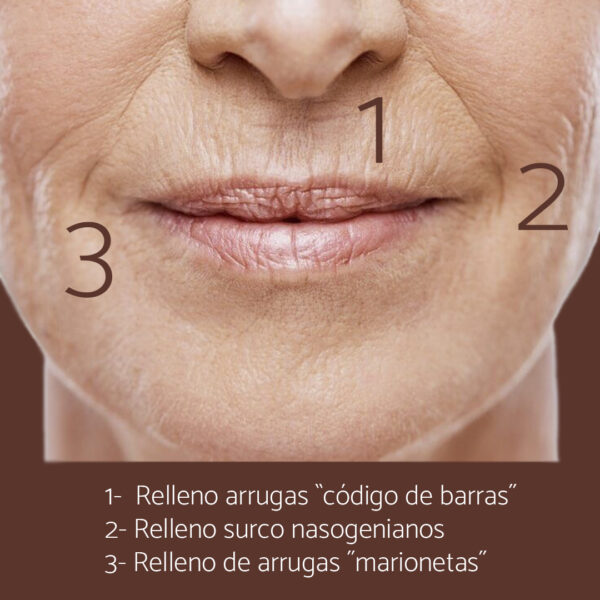 Ácido Hialurónico 1 ml - Imagen 3